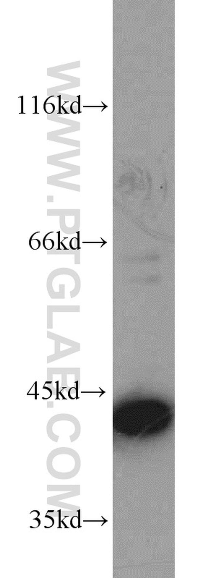 ERK1/2 Antibody in Western Blot (WB)