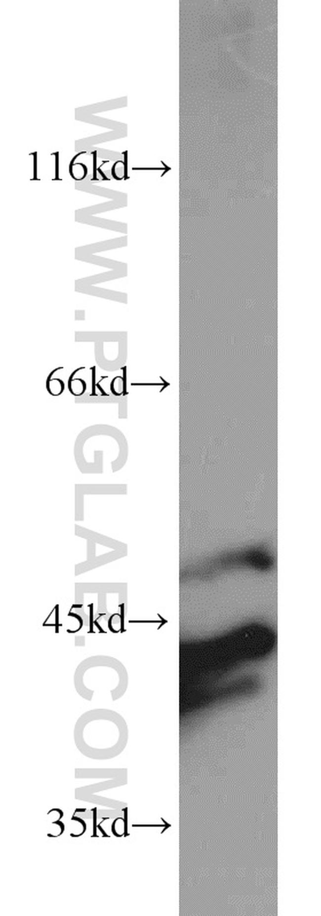 ERK1/2 Antibody in Western Blot (WB)