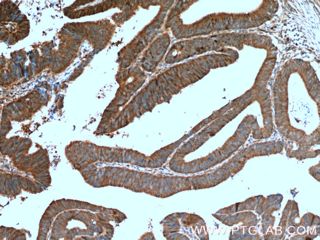 ERK1/2 Antibody in Immunohistochemistry (Paraffin) (IHC (P))