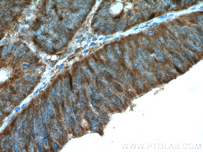 ERK1/2 Antibody in Immunohistochemistry (Paraffin) (IHC (P))