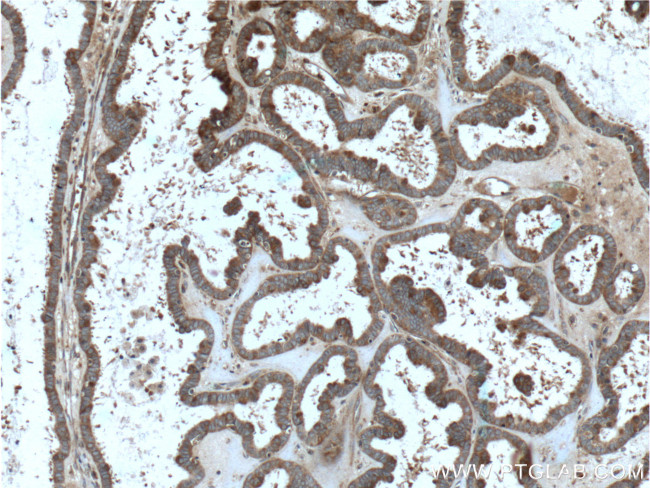 FMN2 Antibody in Immunohistochemistry (Paraffin) (IHC (P))