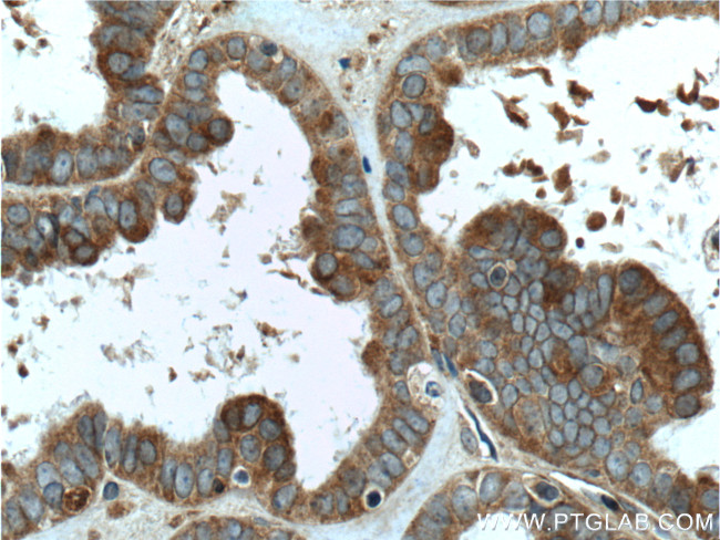 FMN2 Antibody in Immunohistochemistry (Paraffin) (IHC (P))