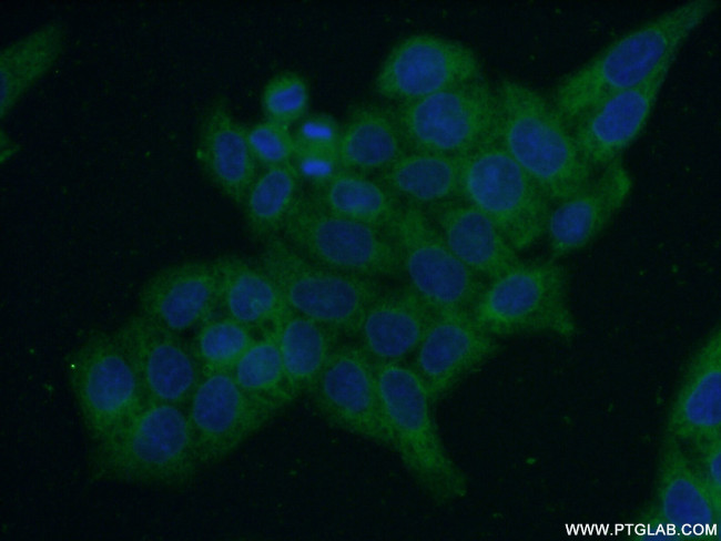 ERO1LB Antibody in Immunocytochemistry (ICC/IF)