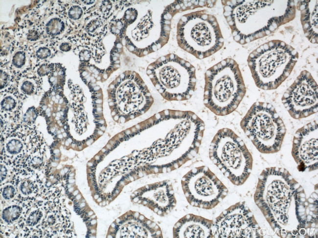 ERO1LB Antibody in Immunohistochemistry (Paraffin) (IHC (P))