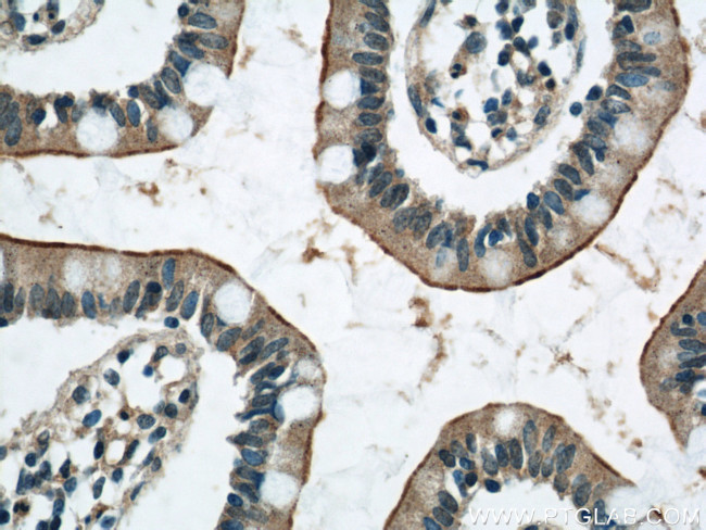 ERO1LB Antibody in Immunohistochemistry (Paraffin) (IHC (P))