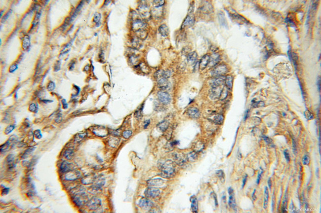 ERO1LB Antibody in Immunohistochemistry (Paraffin) (IHC (P))