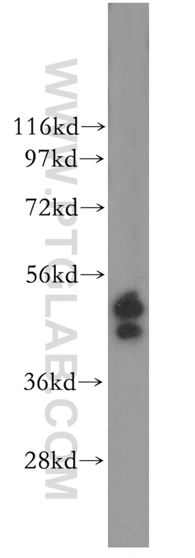 ERO1LB Antibody in Western Blot (WB)