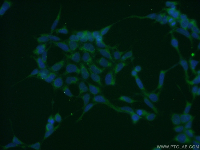 ATG3 Antibody in Immunocytochemistry (ICC/IF)