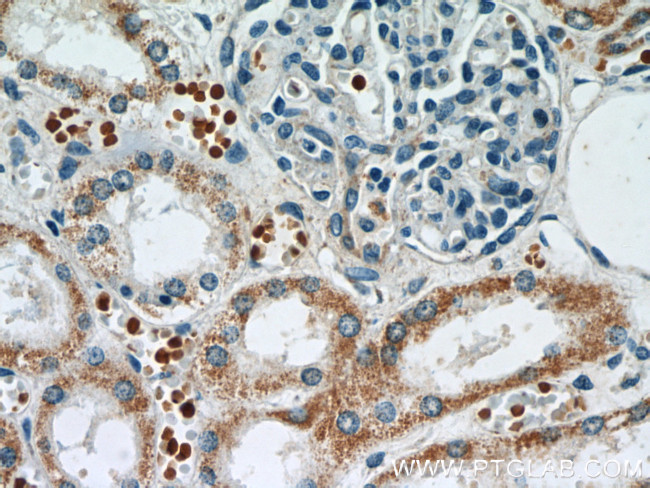 ATG3 Antibody in Immunohistochemistry (Paraffin) (IHC (P))