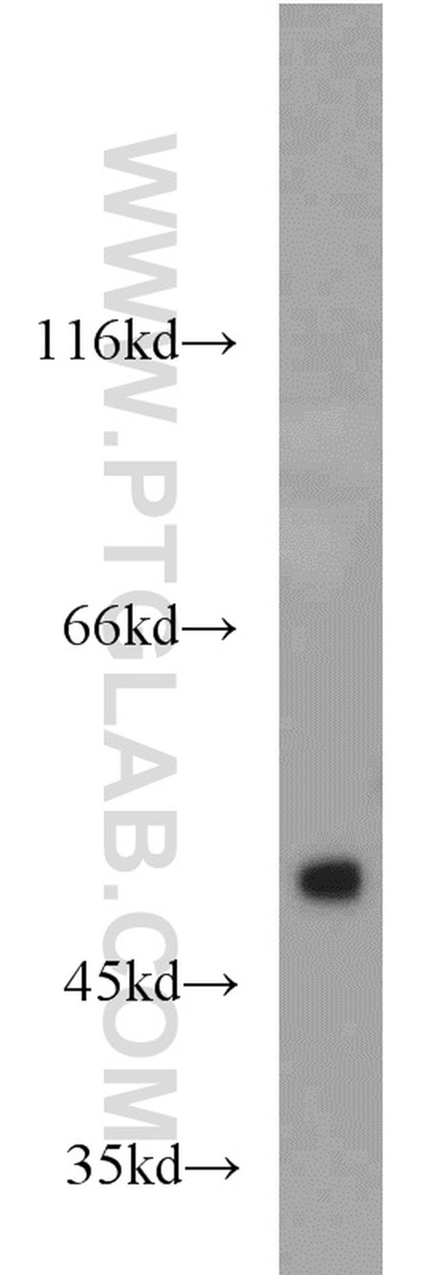 OCT4 Antibody in Western Blot (WB)