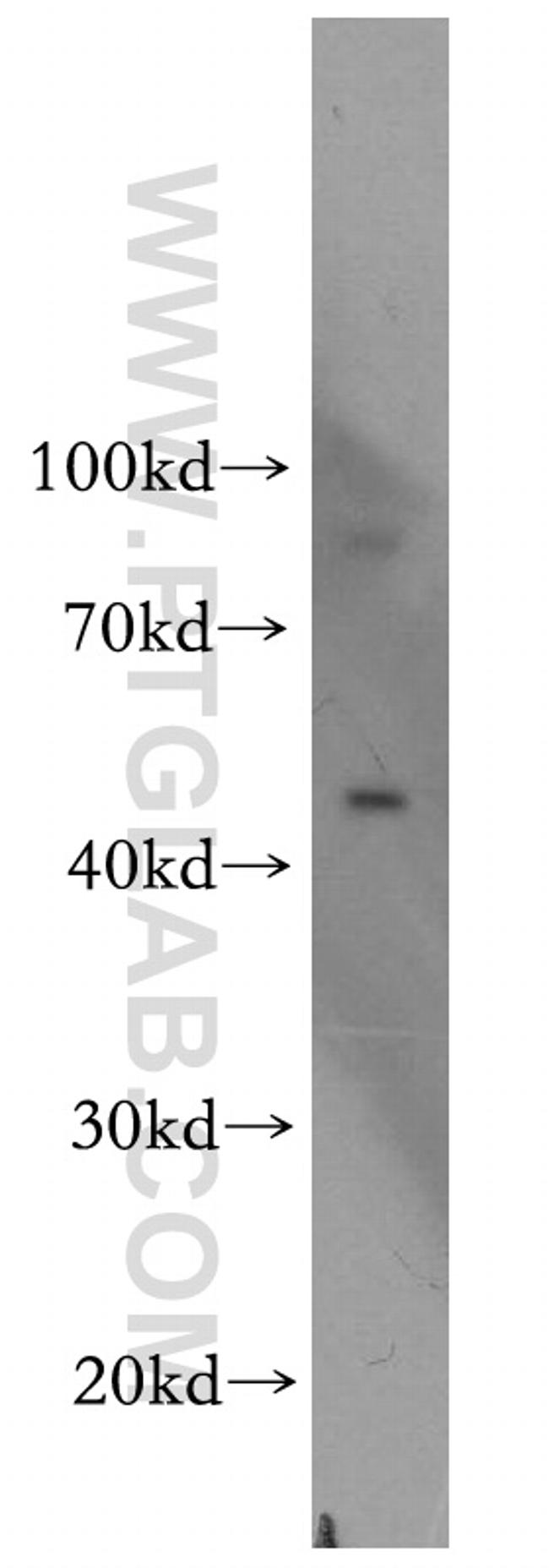 OCT4 Antibody in Western Blot (WB)