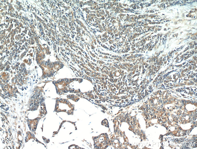 ATG12 Antibody in Immunohistochemistry (Paraffin) (IHC (P))