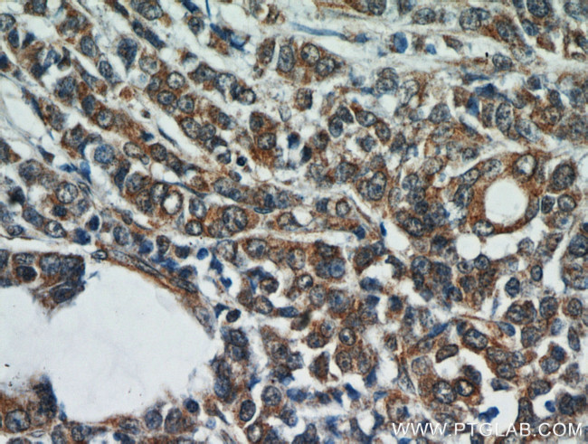 ATG12 Antibody in Immunohistochemistry (Paraffin) (IHC (P))