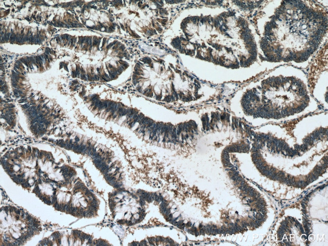 ATG12 Antibody in Immunohistochemistry (Paraffin) (IHC (P))