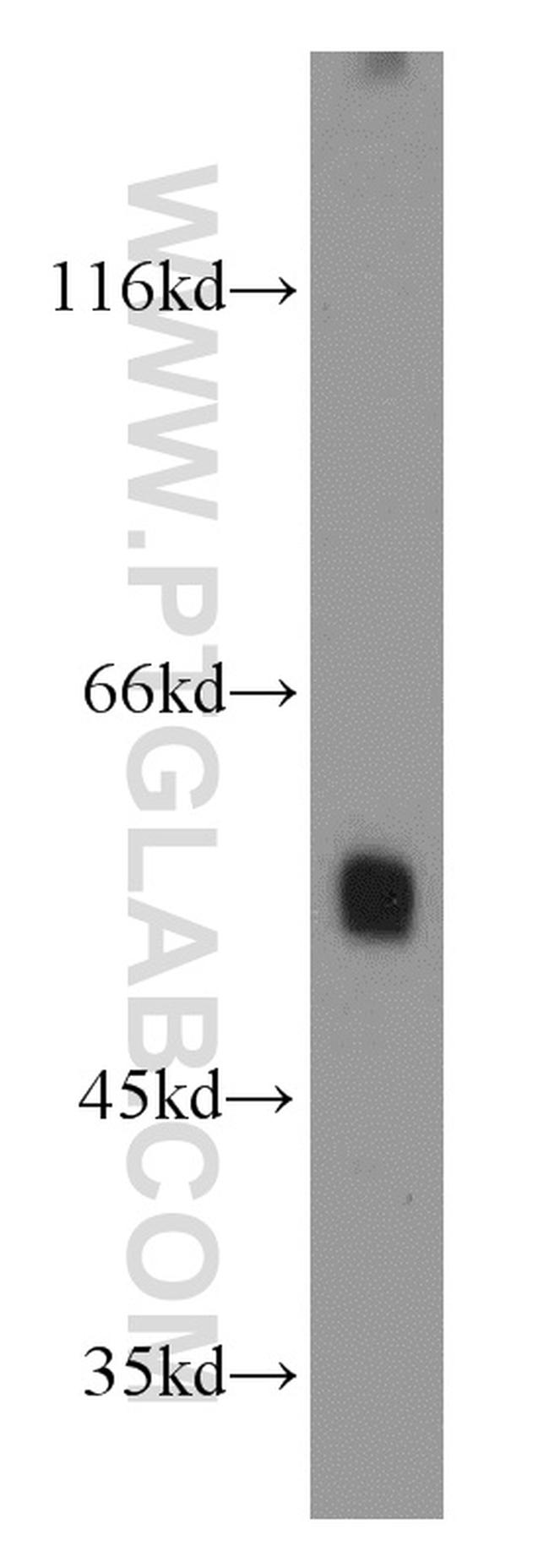 ATG12 Antibody in Western Blot (WB)