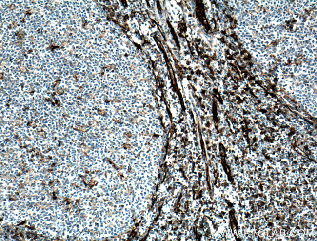 CD31 Antibody in Immunohistochemistry (Paraffin) (IHC (P))