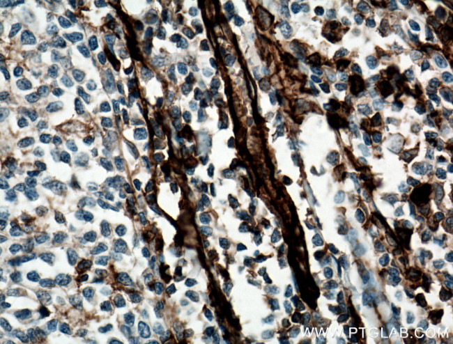 CD31 Antibody in Immunohistochemistry (Paraffin) (IHC (P))