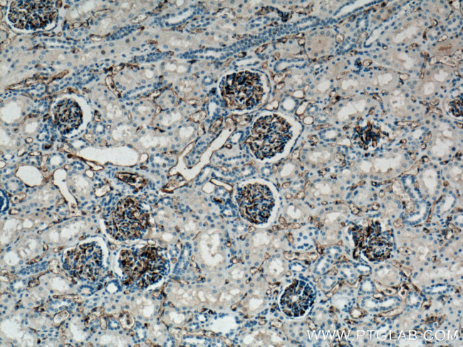 CD31 Antibody in Immunohistochemistry (Paraffin) (IHC (P))