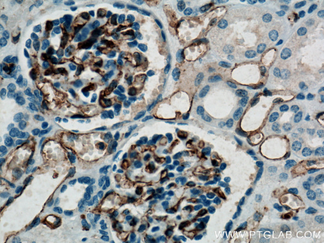 CD31 Antibody in Immunohistochemistry (Paraffin) (IHC (P))