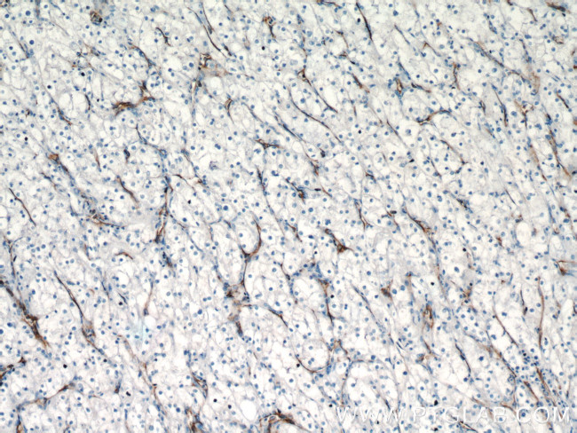 CD31 Antibody in Immunohistochemistry (Paraffin) (IHC (P))