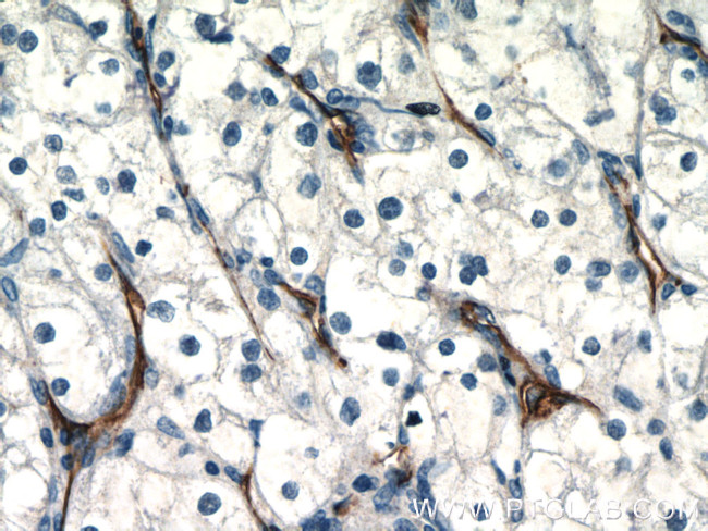 CD31 Antibody in Immunohistochemistry (Paraffin) (IHC (P))