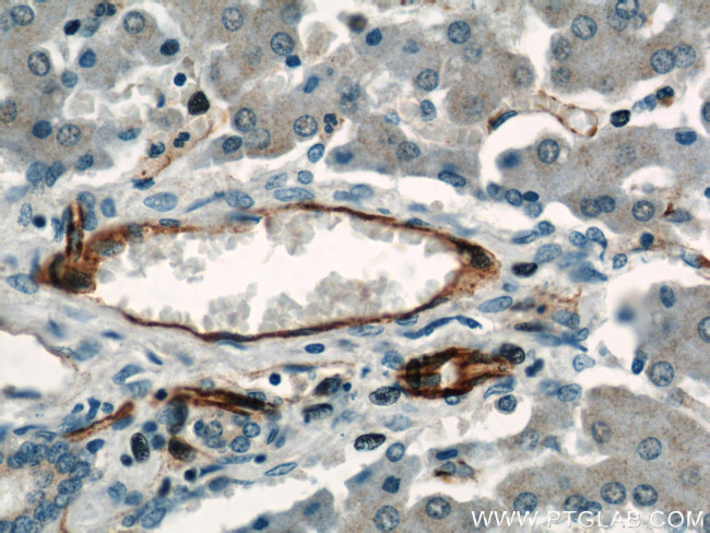 CD31 Antibody in Immunohistochemistry (Paraffin) (IHC (P))