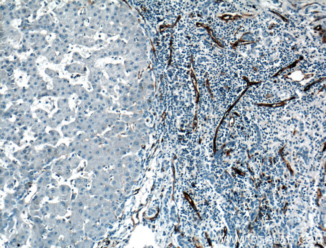 CD31 Antibody in Immunohistochemistry (Paraffin) (IHC (P))