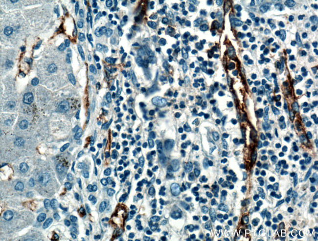 CD31 Antibody in Immunohistochemistry (Paraffin) (IHC (P))