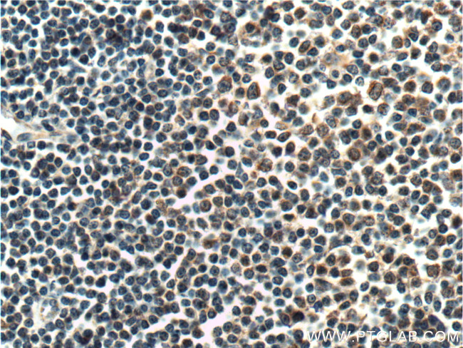 HAX1 Antibody in Immunohistochemistry (Paraffin) (IHC (P))