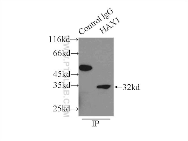 HAX1 Antibody in Immunoprecipitation (IP)