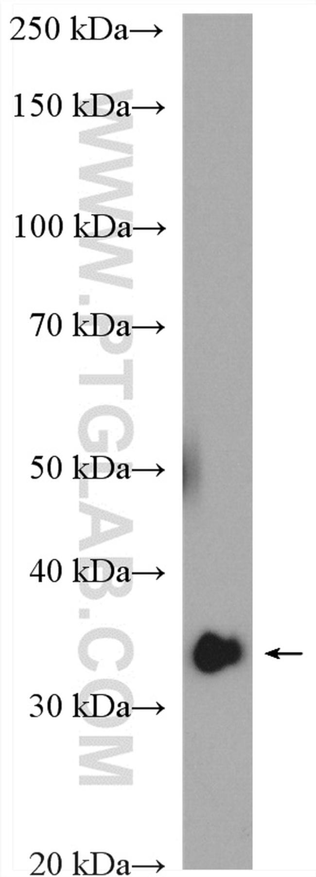 HAX1 Antibody in Western Blot (WB)