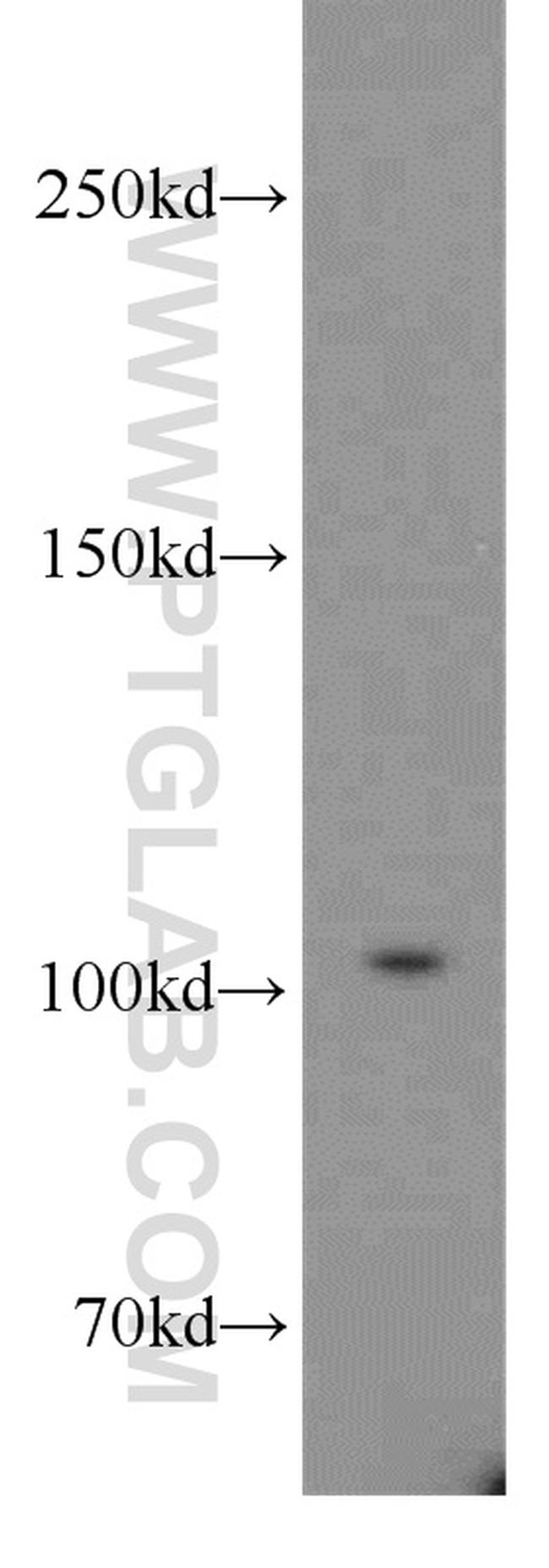 XRN2 Antibody in Western Blot (WB)