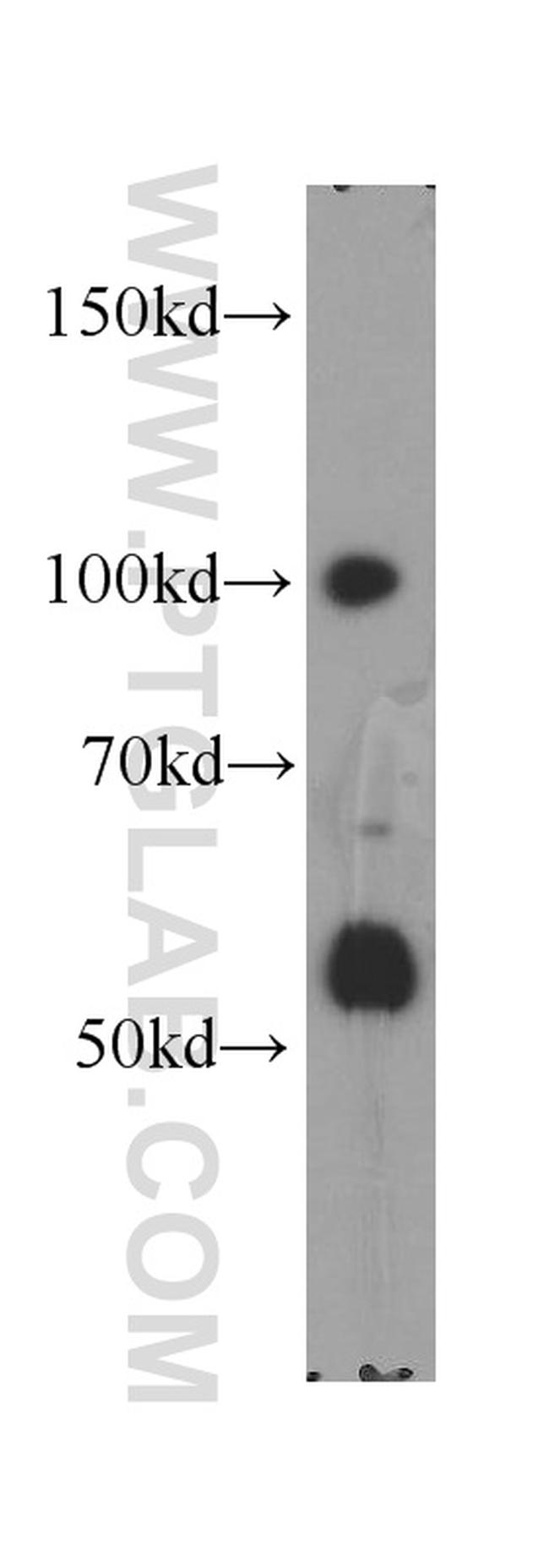 XRN2 Antibody in Western Blot (WB)