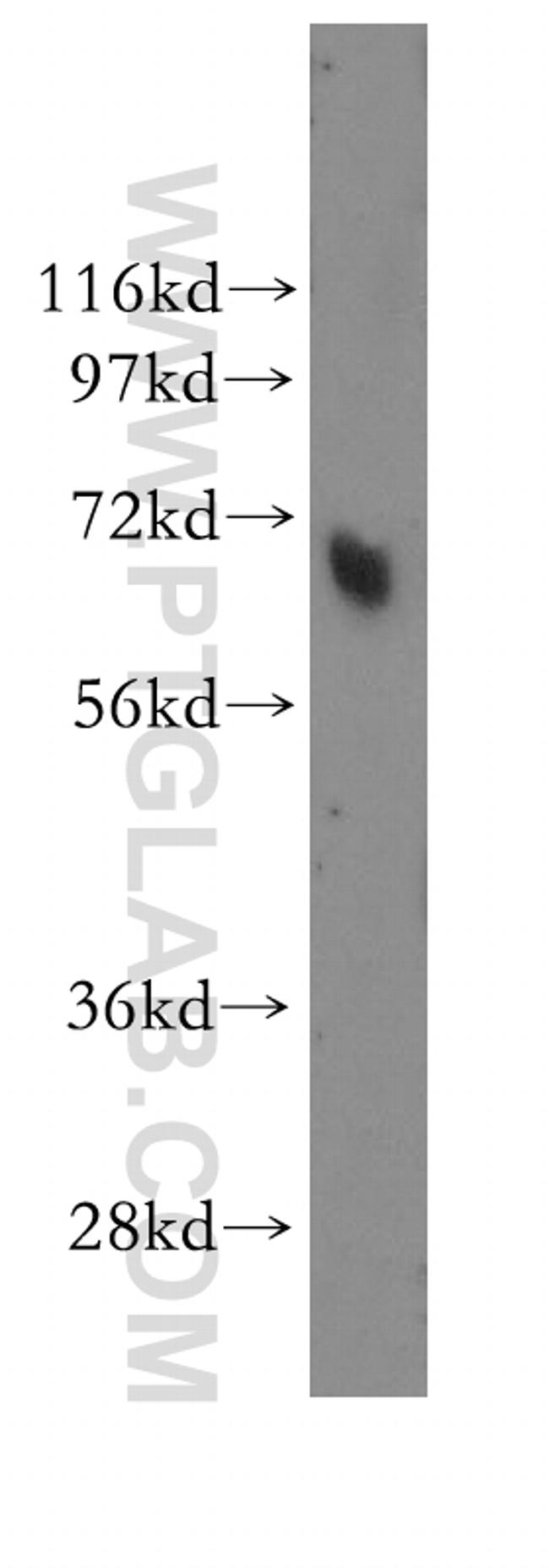 MBD4 Antibody in Western Blot (WB)