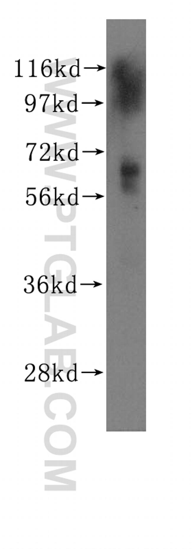 MBD4 Antibody in Western Blot (WB)