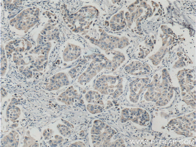 ASAH1 Antibody in Immunohistochemistry (Paraffin) (IHC (P))