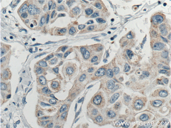 ASAH1 Antibody in Immunohistochemistry (Paraffin) (IHC (P))