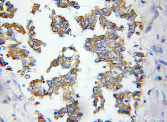 ASAH1 Antibody in Immunohistochemistry (Paraffin) (IHC (P))