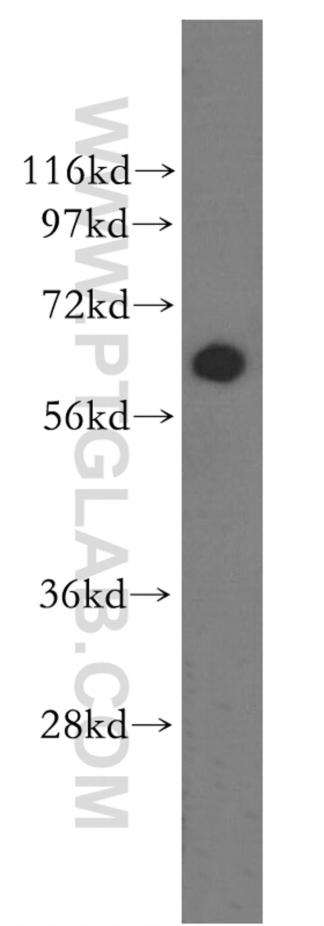 ASAH1 Antibody in Western Blot (WB)