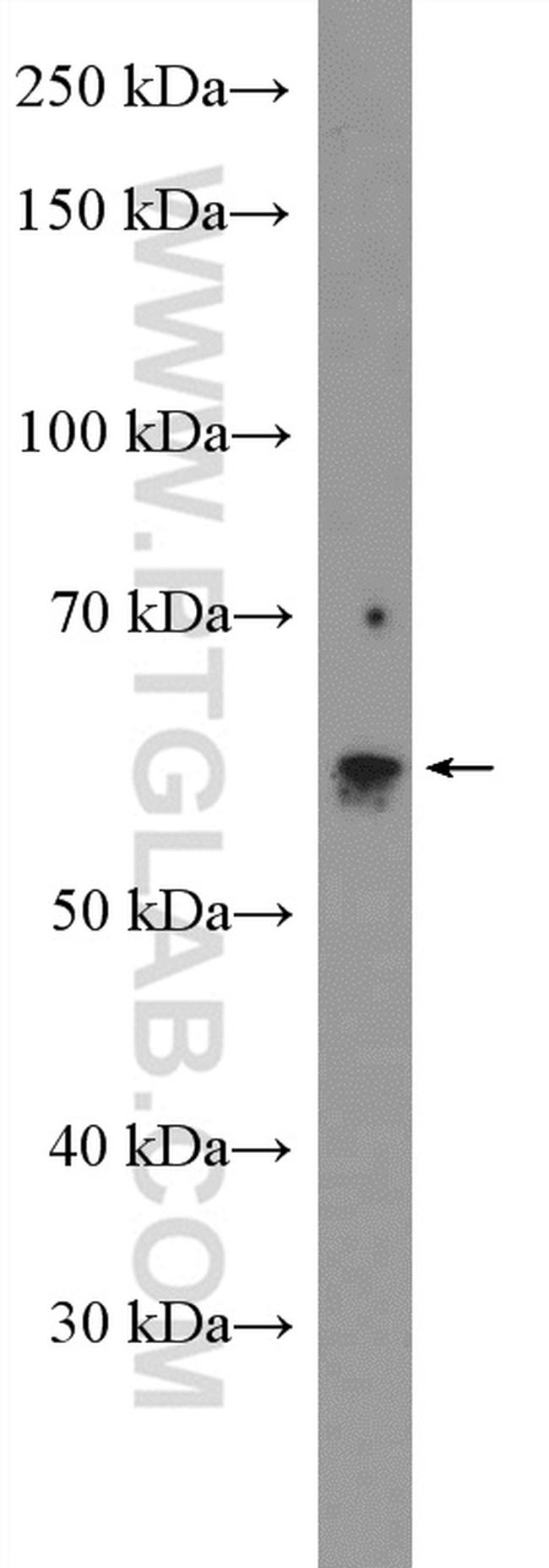 ASAH1 Antibody in Western Blot (WB)