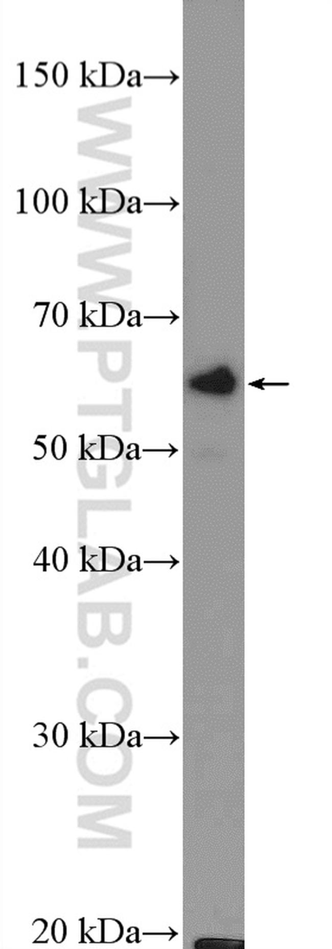 ASAH1 Antibody in Western Blot (WB)