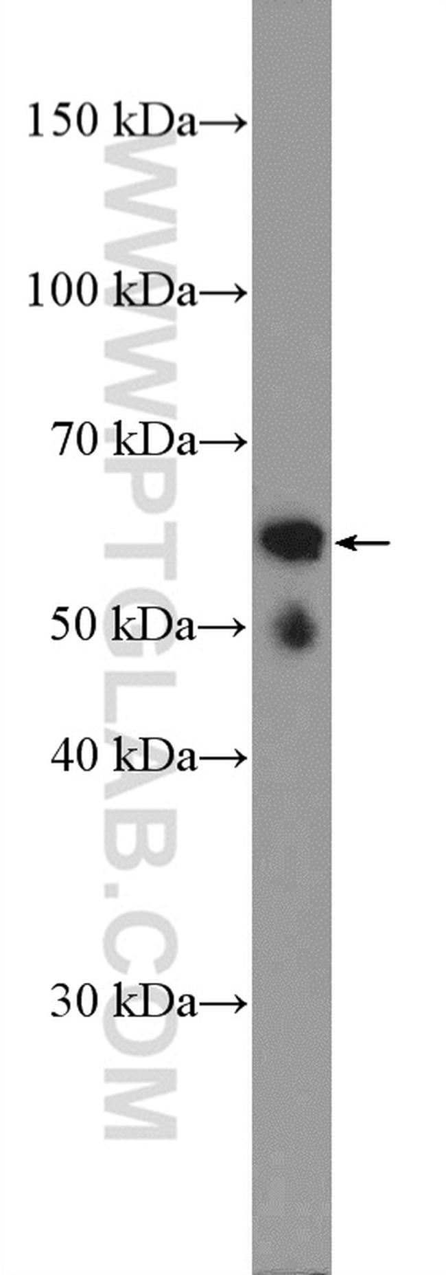 ASAH1 Antibody in Western Blot (WB)