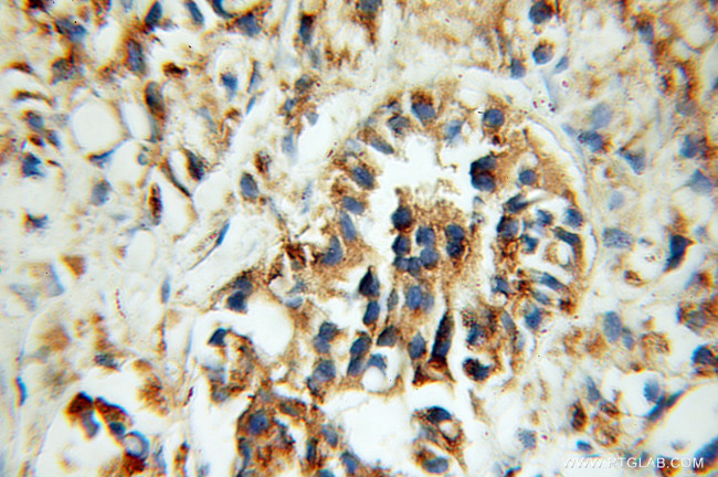 CREB3 Antibody in Immunohistochemistry (Paraffin) (IHC (P))