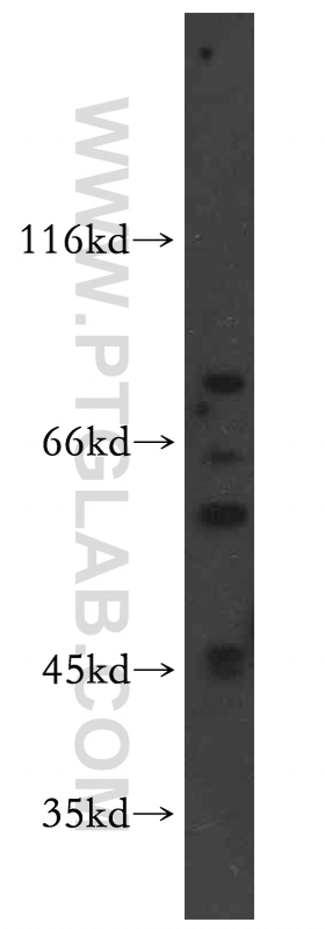 CREB3 Antibody in Western Blot (WB)