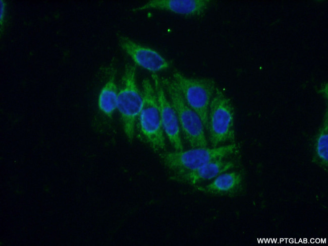 CREB3 Antibody in Immunocytochemistry (ICC/IF)