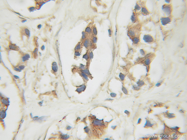 CREB3 Antibody in Immunohistochemistry (Paraffin) (IHC (P))