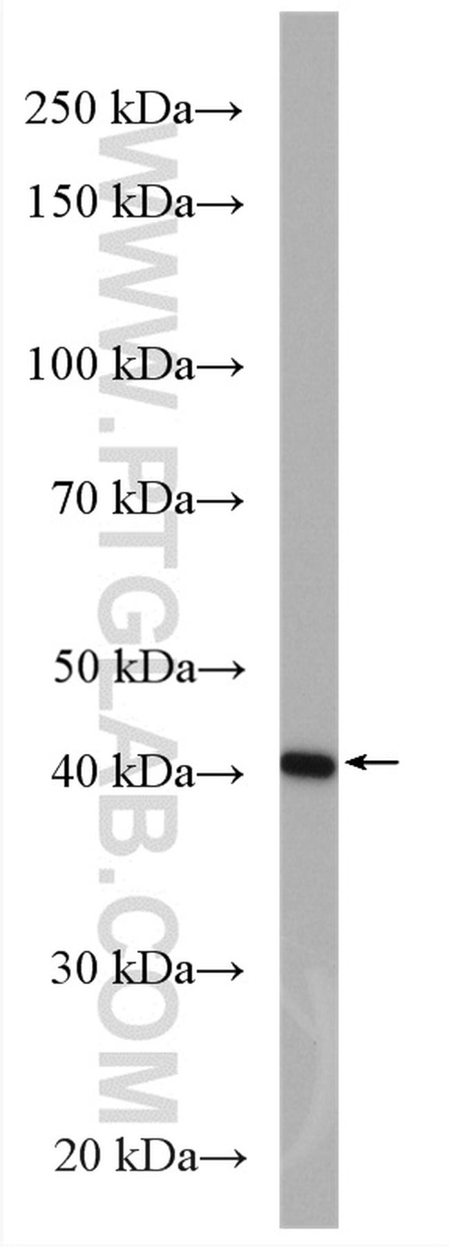 CREB3 Antibody in Western Blot (WB)