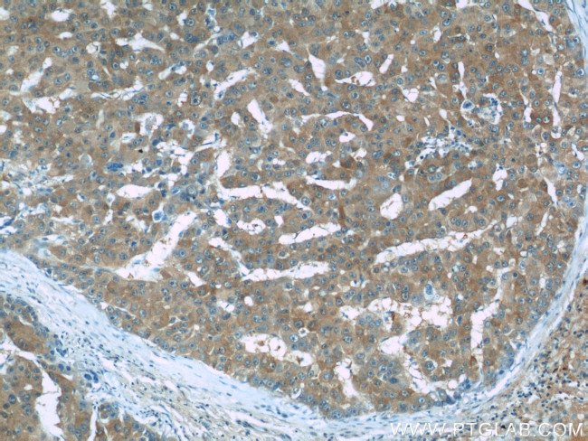 RMP Antibody in Immunohistochemistry (Paraffin) (IHC (P))