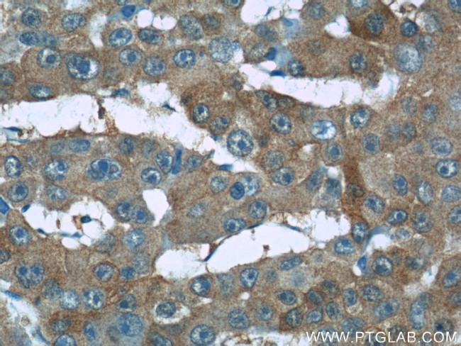 RMP Antibody in Immunohistochemistry (Paraffin) (IHC (P))