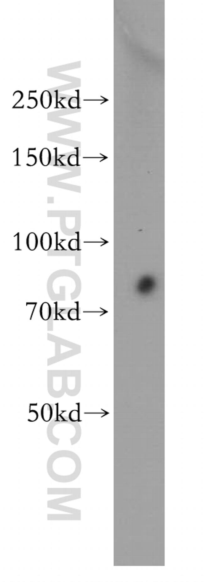 RMP Antibody in Western Blot (WB)